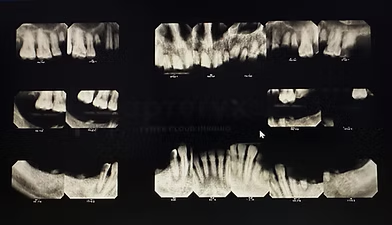 Dental X-ray of a full mouth