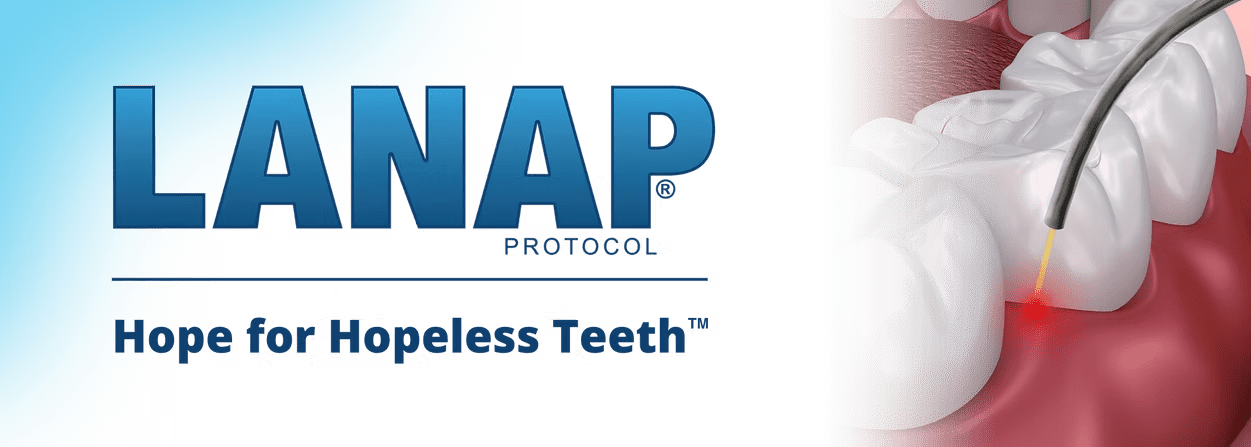LANAP Protocol - Hope for Hopeless Teeth